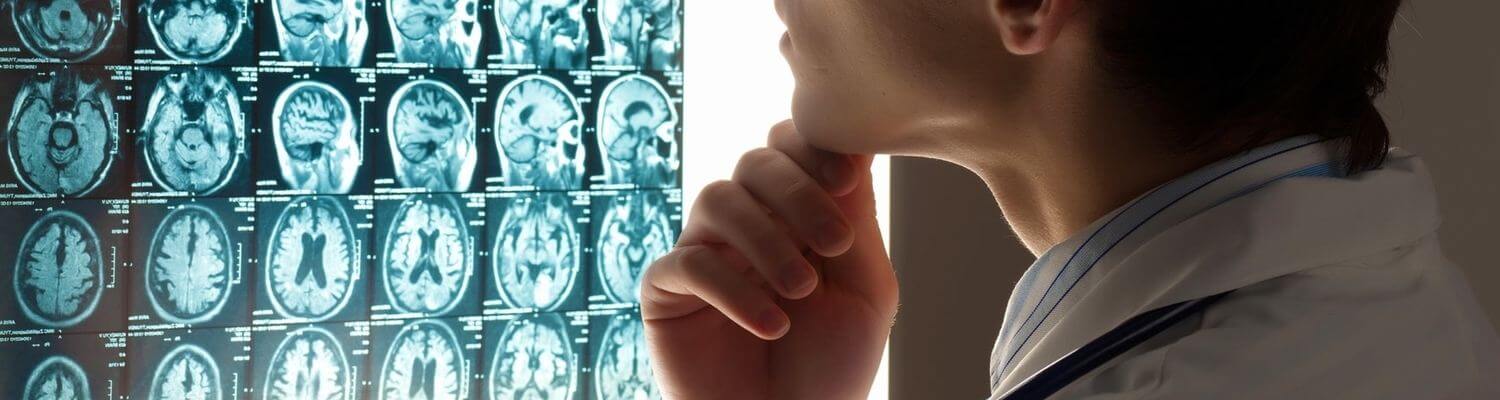 How Long Do You Have to File a Brain Injury Claim in California?