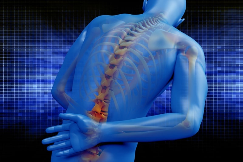 I Suffered a Herniated Disc After a Car Accident in California: How Much is My Case Worth?